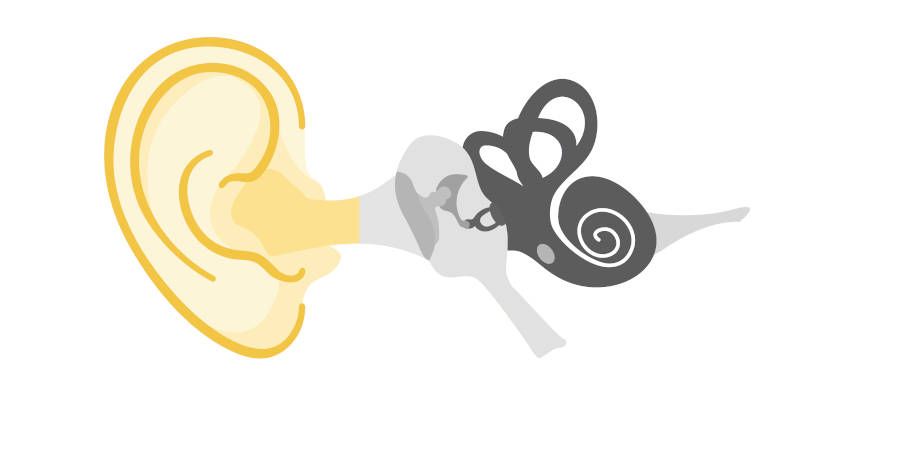 Tipos Pérdida audición